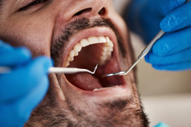 Best Emergency Dental Care for Broken or Chipped Teeth in Mount Ayr, IA